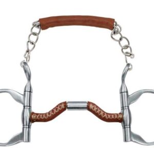 METALAB Spanish Dentures - Francois Gauthier